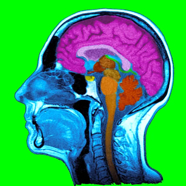 Sagittal bölümü — Stok fotoğraf