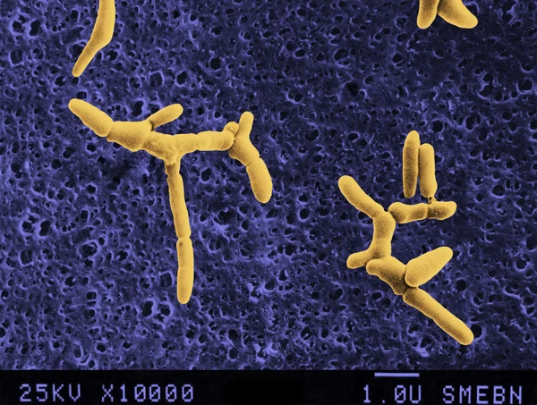 Bacterias anaerobias — Foto de Stock