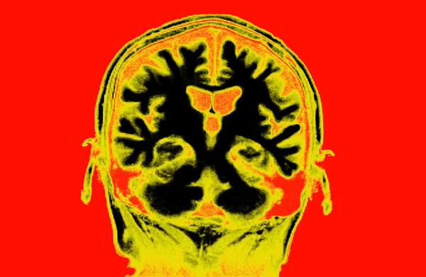 Examen del cerebro — Foto de Stock