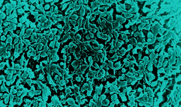 Zápal plic bakterie — Stock fotografie
