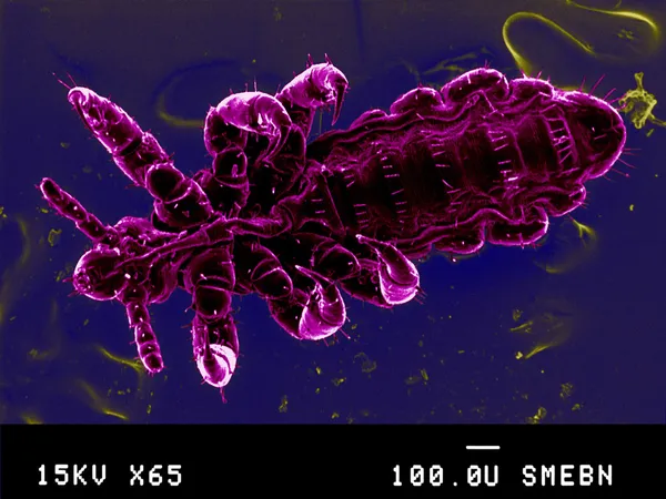 Pidocchio al microscopio — Foto Stock