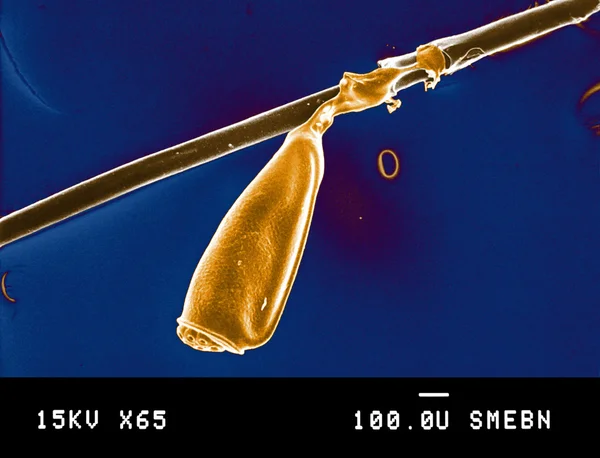 Pediculosis bajo el microscopio —  Fotos de Stock