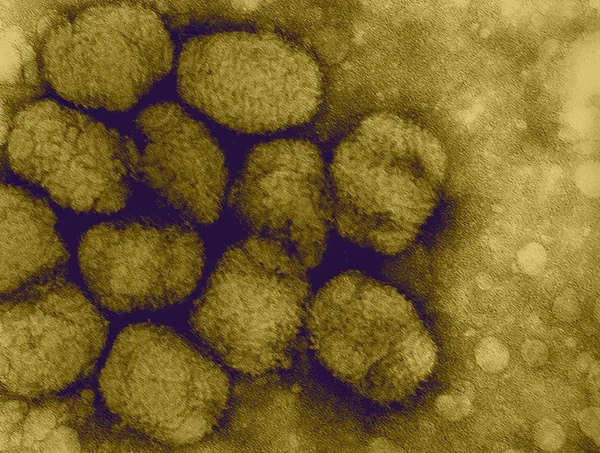 Virus del vaiolo — Foto Stock