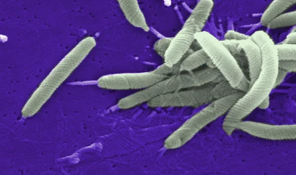 Flexispira bajo el microscopio — Foto de Stock