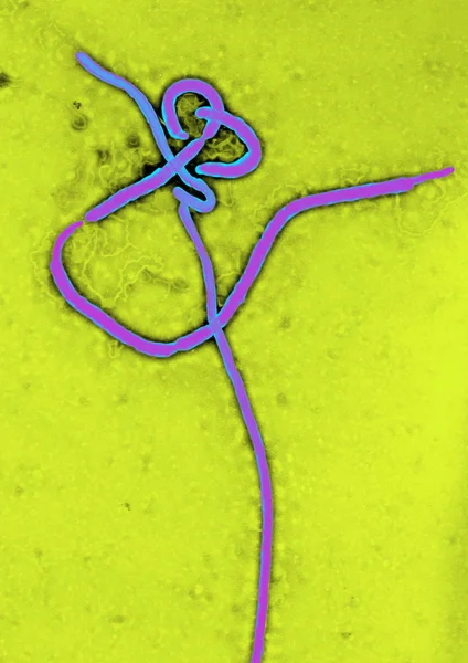 Virus del Ébola — Foto de Stock