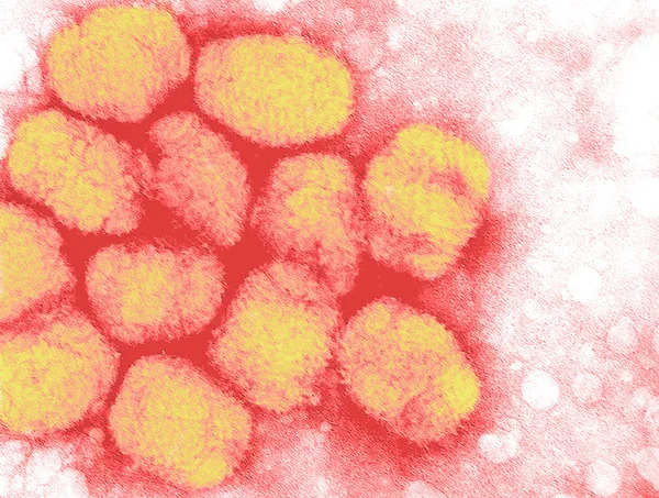 顕微鏡の下で orthopoxvirus — ストック写真