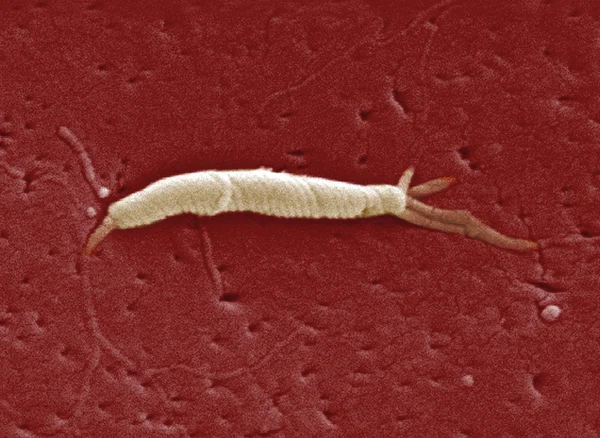 Flexispira bakteri — Stok fotoğraf