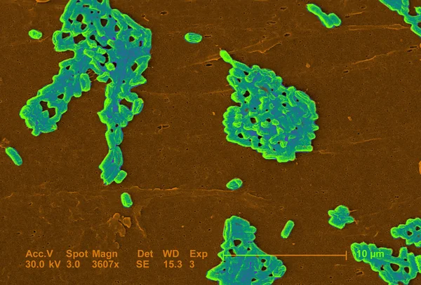 Escherichia Coli — Stock fotografie