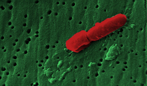 Инфекция под микроскопом
