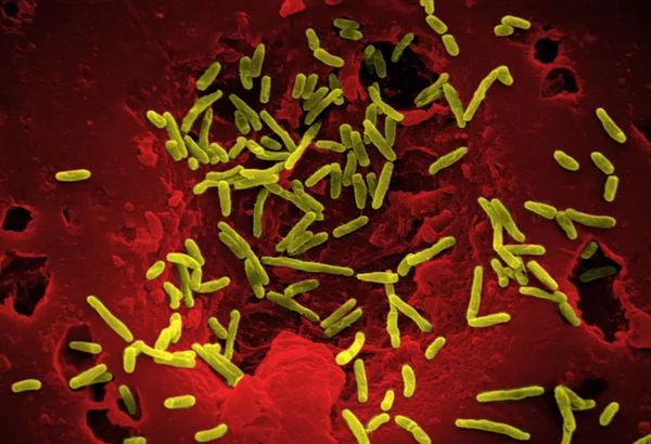 Mycobacterium chelonae — Fotografia de Stock
