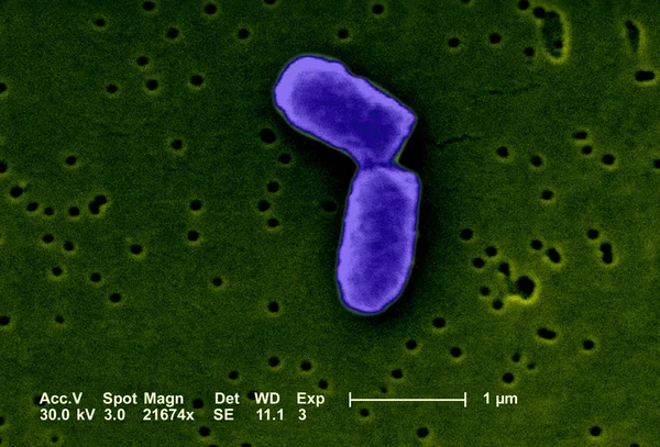 Escherichia coli under the microscope — Stock Photo, Image