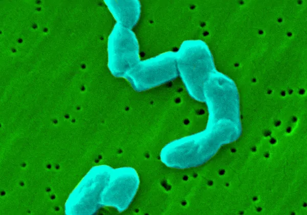 Salmonella bacteria — Stock Photo, Image