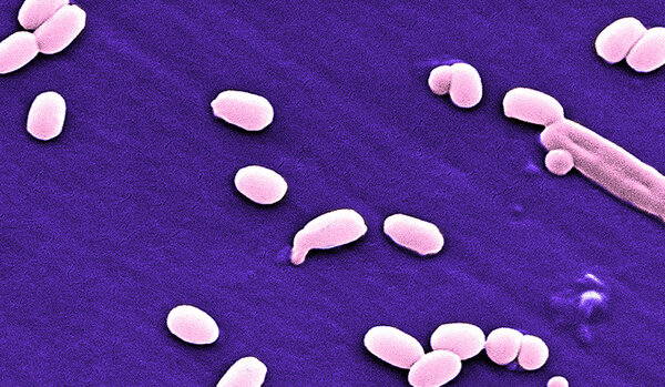 Бактерии сибирской язвы
