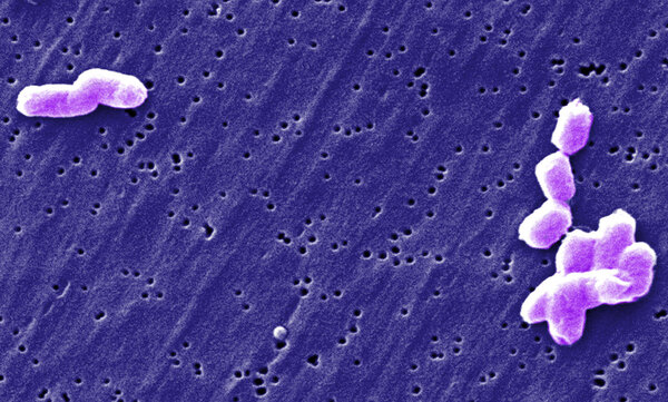 Сальмонелла под микроскопом

