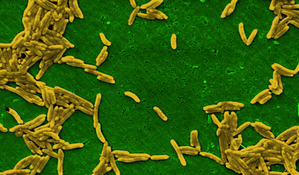 Bacterium under microscope