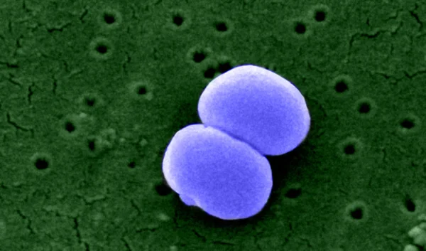 Aureus onder Microscoop — Stockfoto