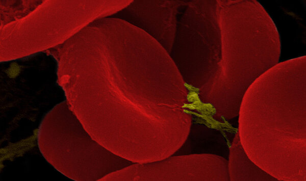 Корпуса крови
