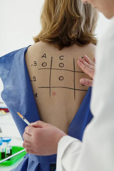 ALLERGY TEST, WOMAN — Stock Photo, Image