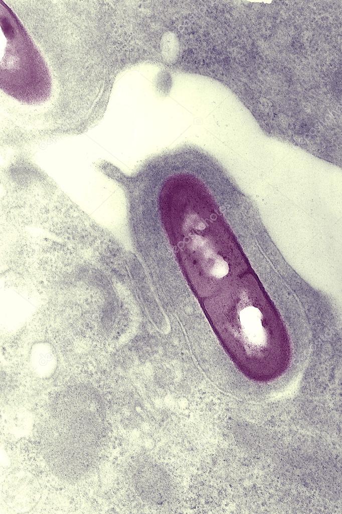 Listeria bacterium in tissue