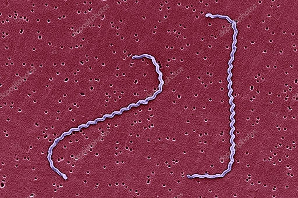 Leptospira interrogans strain RGA — Stock Photo © imagepointfr 44390227