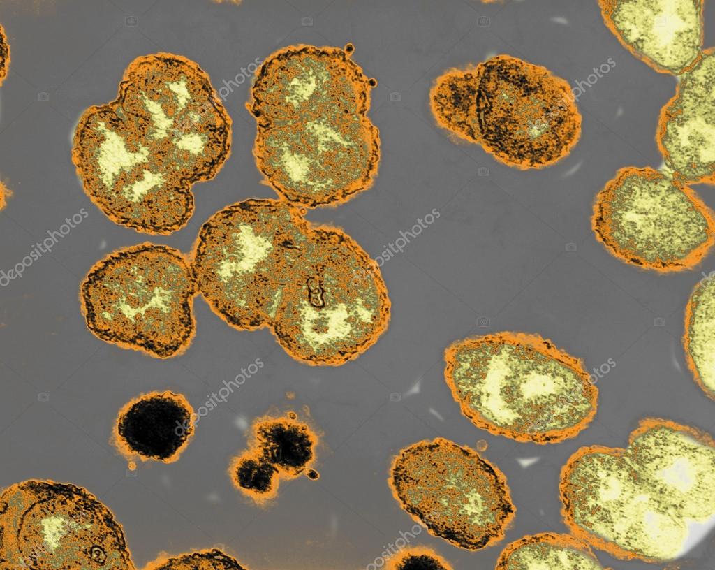 Gonorrhea bacterium — Stock Photo © imagepointfr 44393941