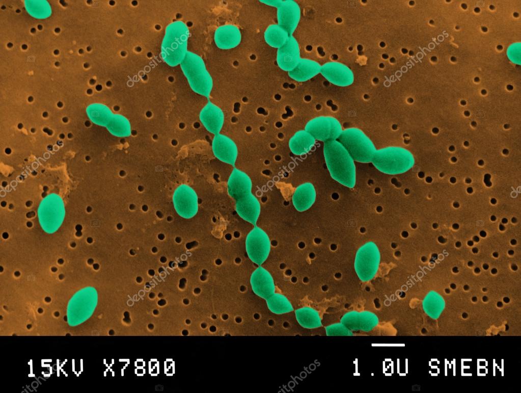 Streptococco al microscopio Foto Stock Foto, Immagini © imagepointfr