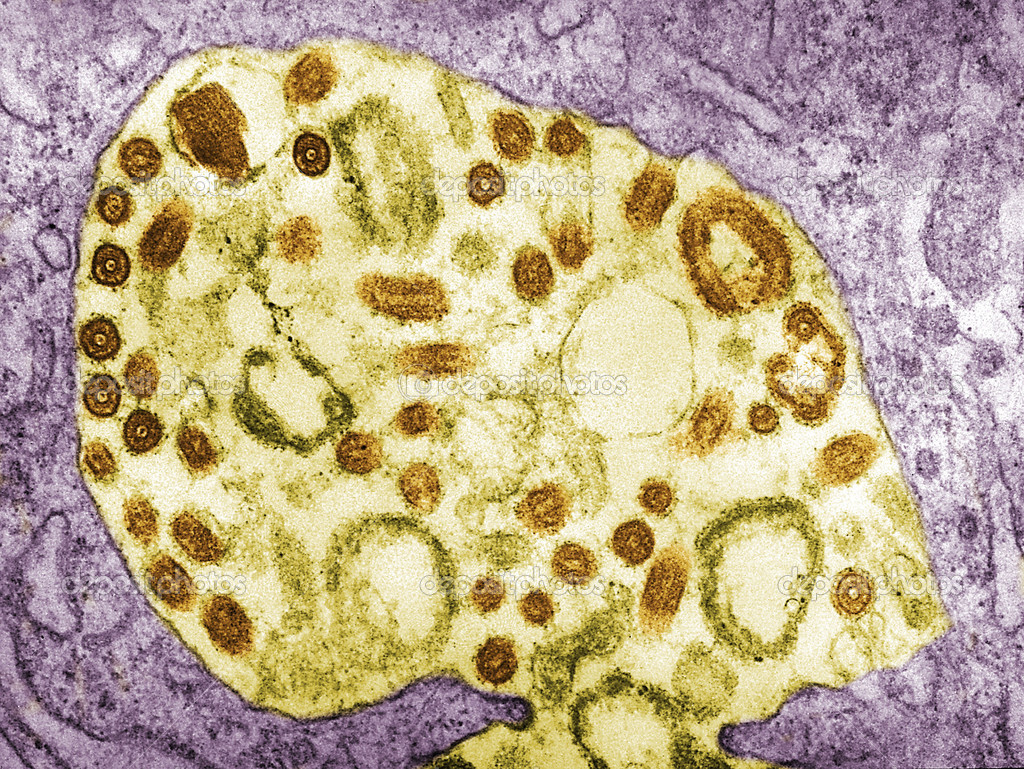 Marburg Virus Stock Photo Image By C Imagepointfr 44394375