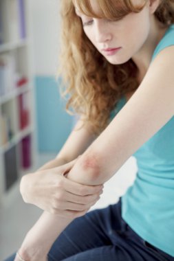 Dermatoloji istişare kadın