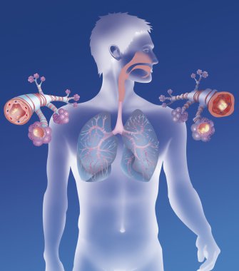 Depiction of a healthy bronchial tube clipart