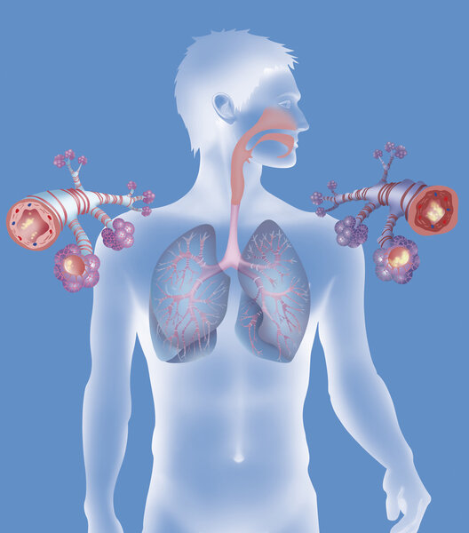 Изображение здоровой бронхиальной трубки

