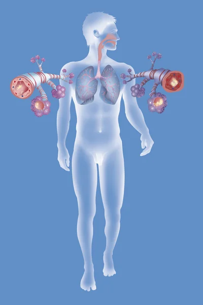 健康的な気管支管の描写 — ストック写真