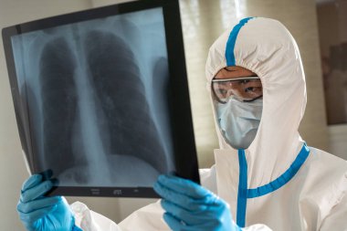Doctor in a Covid ward of a hospital examining x-rays of the lungs.