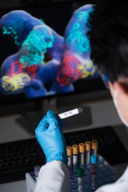 Blood tests to detect sexually transmitted diseases or STDs: hepatitis B and C, syphilis, HIV.