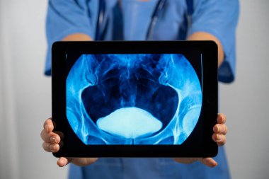 Female doctor holding a screen with bladder x-ray.