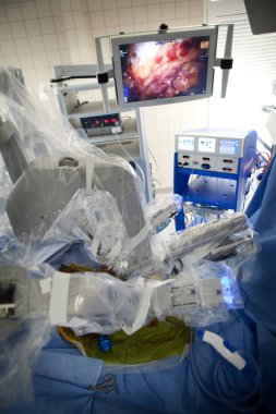 Urology department of a hospital performing prostatectomies using a robot surgeon.