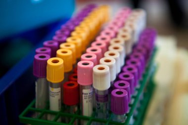 Donate blood in test tubes at a blood collection facility.