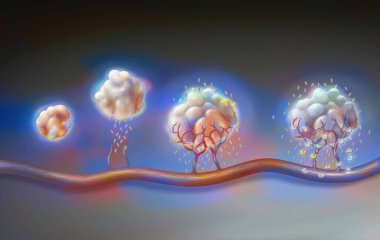 Tumor: from left to right, angiogenesis and antiangiogenic drugs.