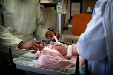 Pediatric emergencies intervene in a hospital for a newborn baby who has breathing difficulties.