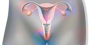 Anatomy of the female reproductive system during menstruation.