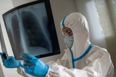 Doctor in a Covid ward of a hospital examining x-rays of the lungs.