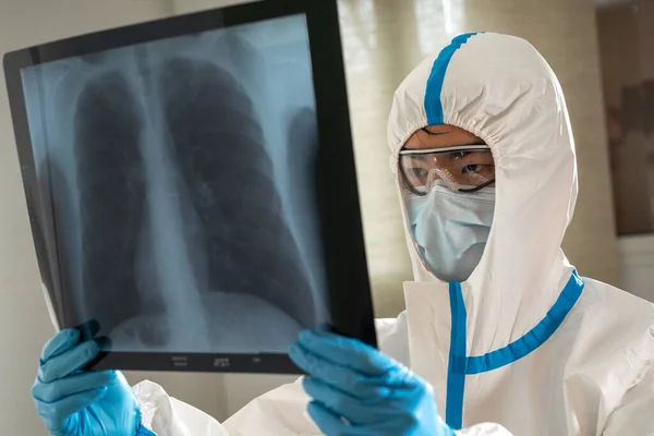 Doctor Covid Ward Hospital Examining Rays Lungs — Stockfoto