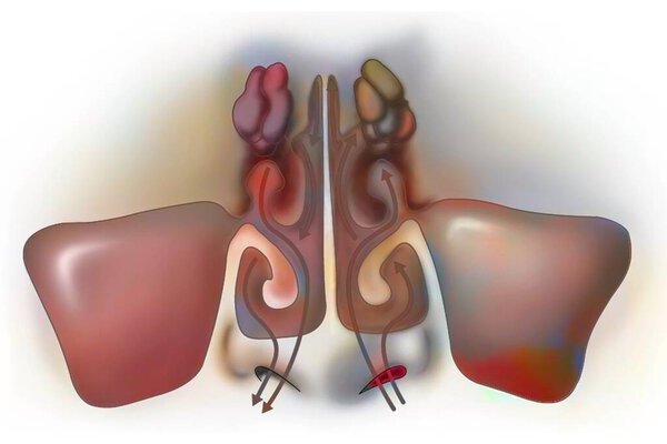 Пазухи: циркуляция воздуха в турбинатах. 