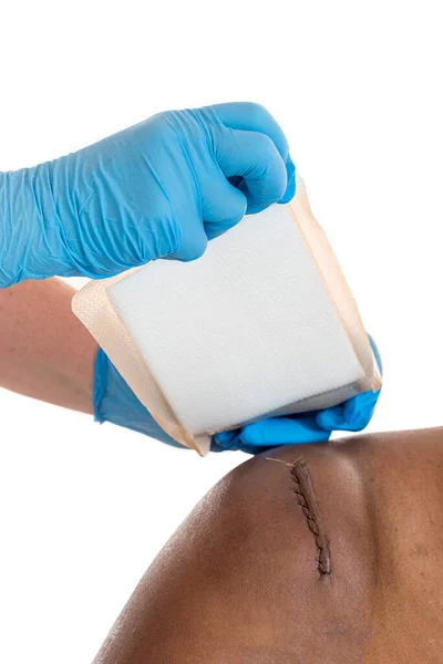 Sticking Plaster Applied Awound Sitched Scar — Stock Photo, Image