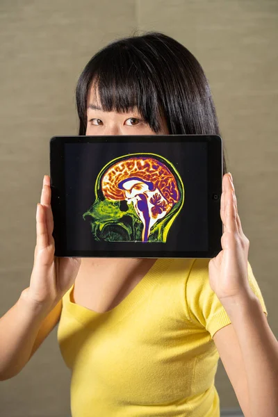 Woman holding screen with cut of brain