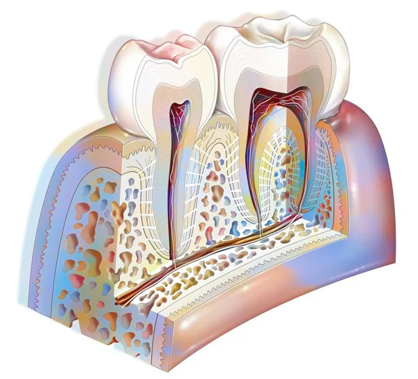 Dental Plaque Main Pathologies Teeth Tartar Gingivitis — Stock Photo, Image