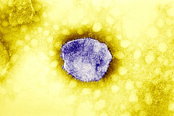 Tacaribe Complex New World Arenaviruses Electron Micrograph Arenaviridae Arenaviridae Rna — 图库照片