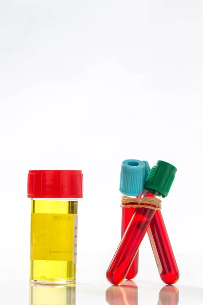 Blood Urine Samples — Foto de Stock