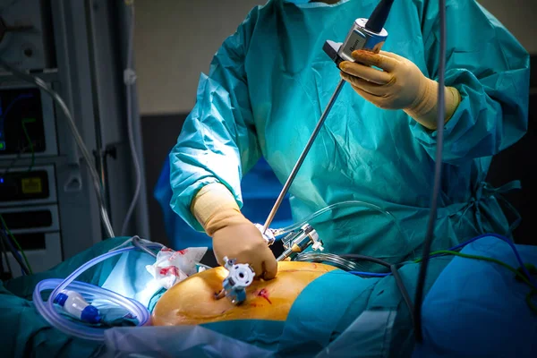 Hysterectomy Operating Room Robot Surgeon Installation Four Arms Robot Including — 스톡 사진