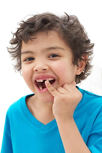 Toothless Boy Close Portrait — Foto de Stock