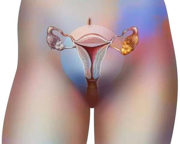 Anterior View Female Genitals Vagina Uterus Fallopian Tubes Ovaries — Foto Stock